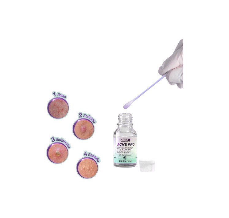 APEX アクネプロパウダーローション 15ml